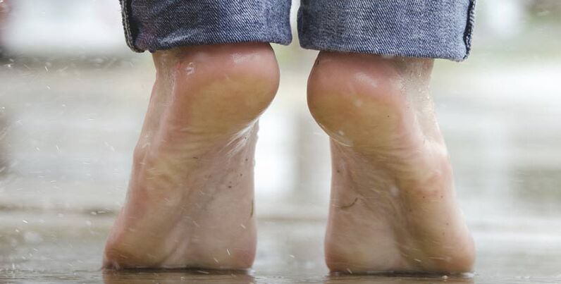 You can forget plantar warts with cleaning methods