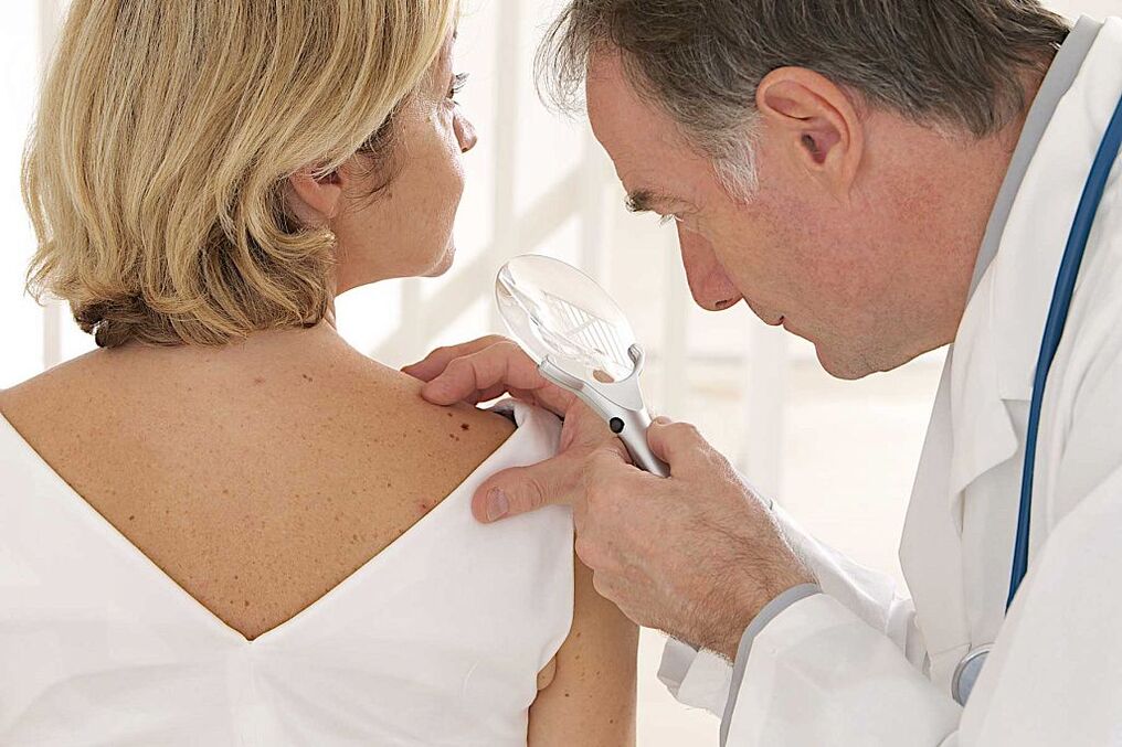 diagnosis of human papillomavirus